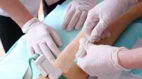 HIV progress stunted by complex health system, report shows